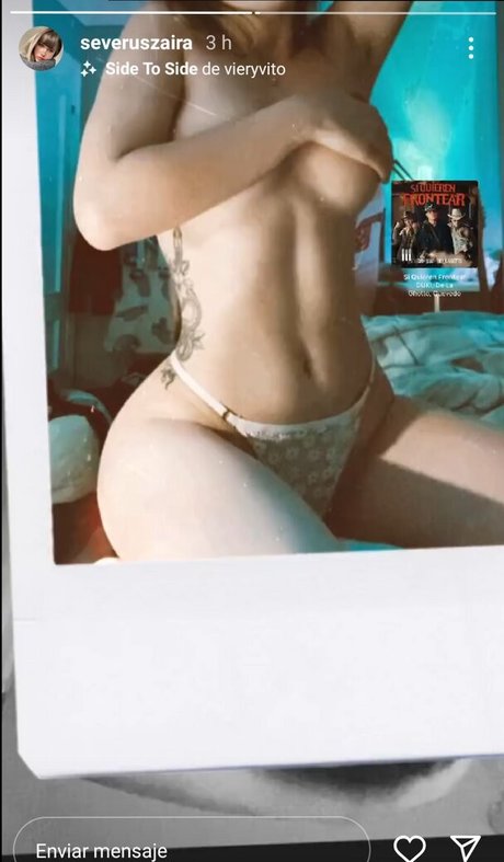 Severuszaira