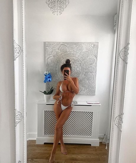 Misskayleighrosedematos