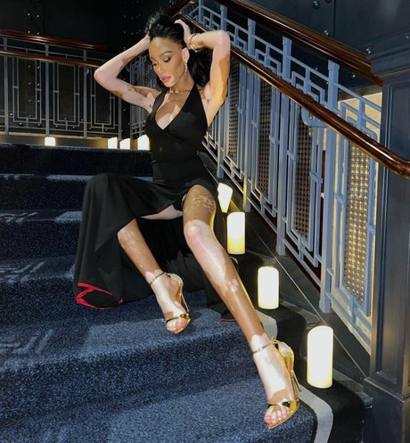 Winnie Harlow