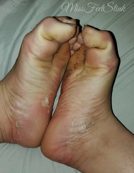 Missfeetstinkvip