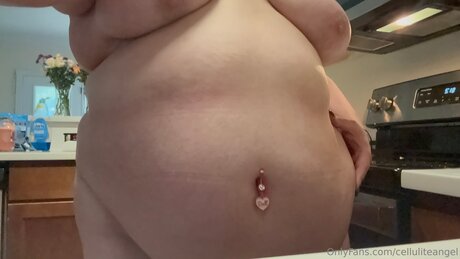 Celluliteangel