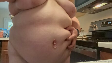 Celluliteangel