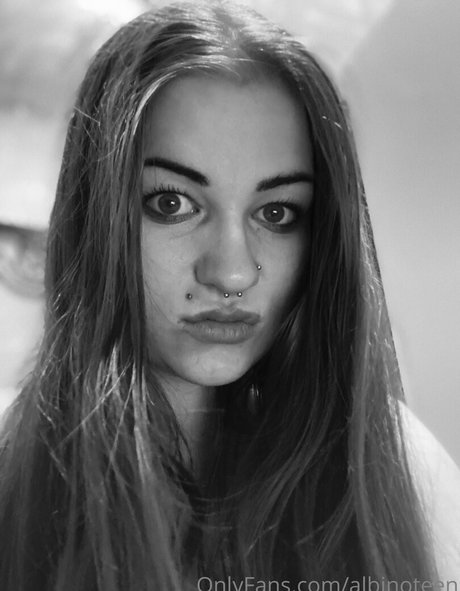 Photo nue de fuite OnlyFans de Albinoteen