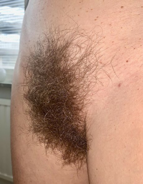 Hairy Women