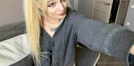Skinnytyan