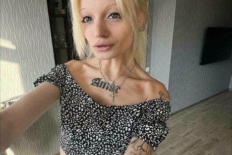 Skinnytyan
