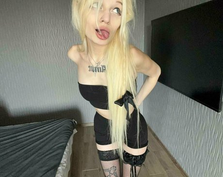 Skinnytyan