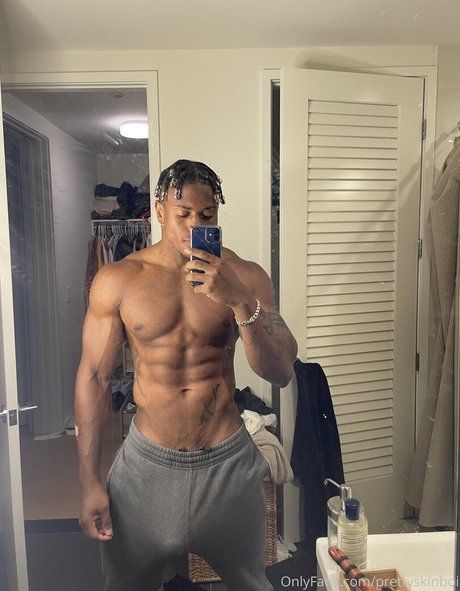 Prettyskinboi