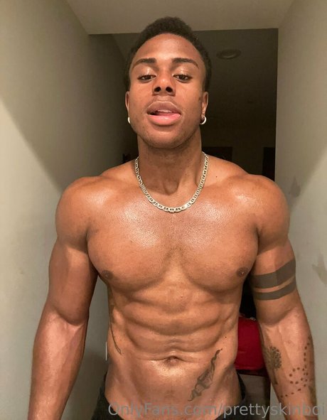 Prettyskinboi