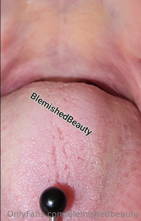 Blemishedbeauty